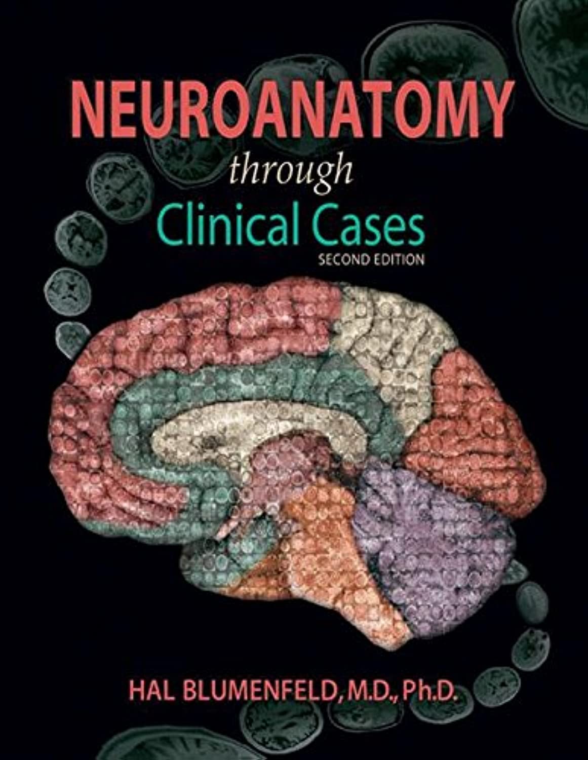 Neuroanatomy through Clinical Cases with ebook: With 2-year subscription to the interactive eBook Medicine