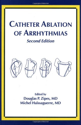 Catheter Ablation of Arrhythmias Medicine