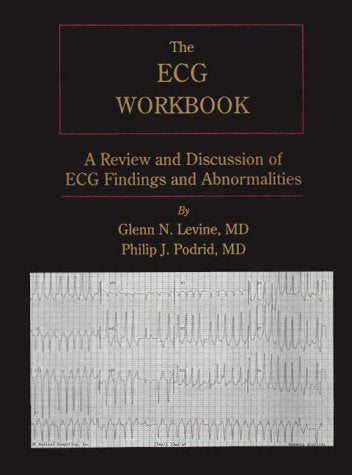 Electrocardiogram Workbook: A Review and Discussion of ECG Findings and Abnormalities Medicine