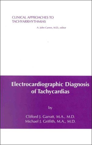Electrocardiographic Diagnosis of Tachycardias (Clinical Approaches to Tachyarrhythmias, Band 2) Medicine