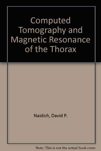 Computed Tomography and Magnetic Resonance of the Thorax Medicine