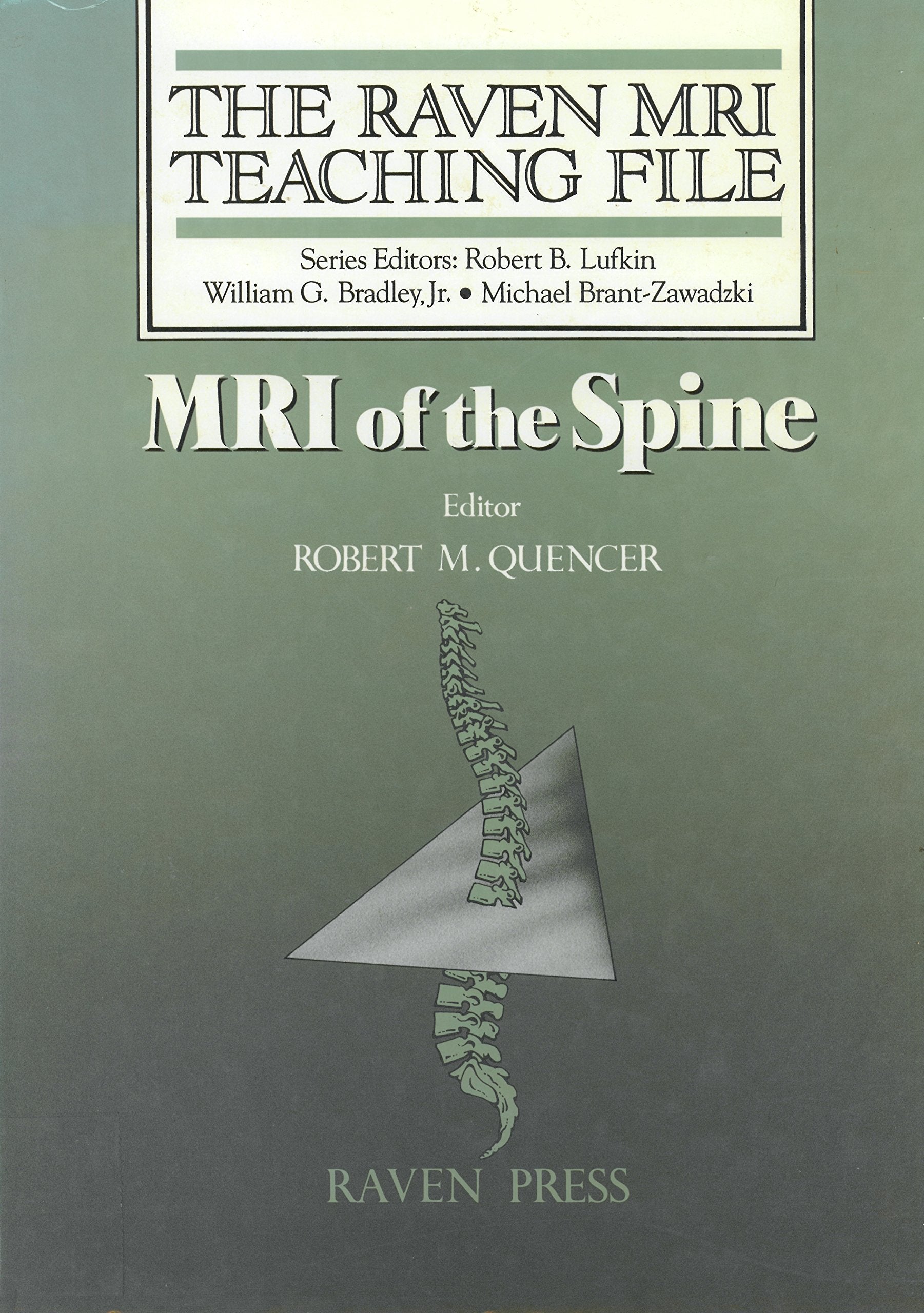 Mri of the Spine book