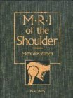 Mri of the Shoulder book