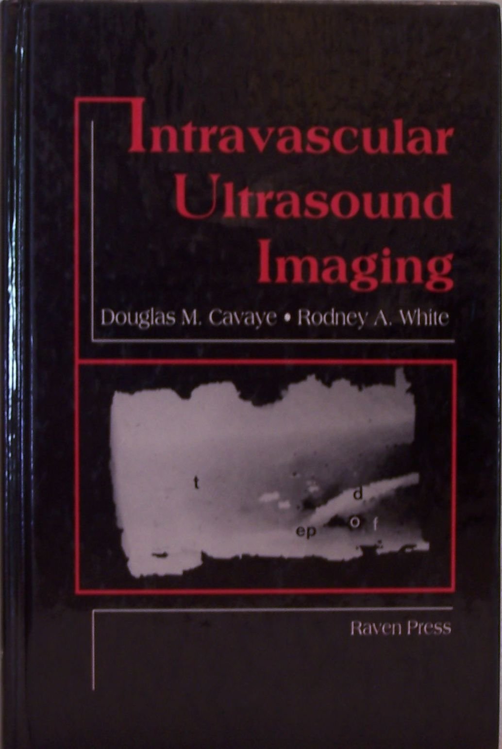 Intravascular Ultrasound Imaging Medicine