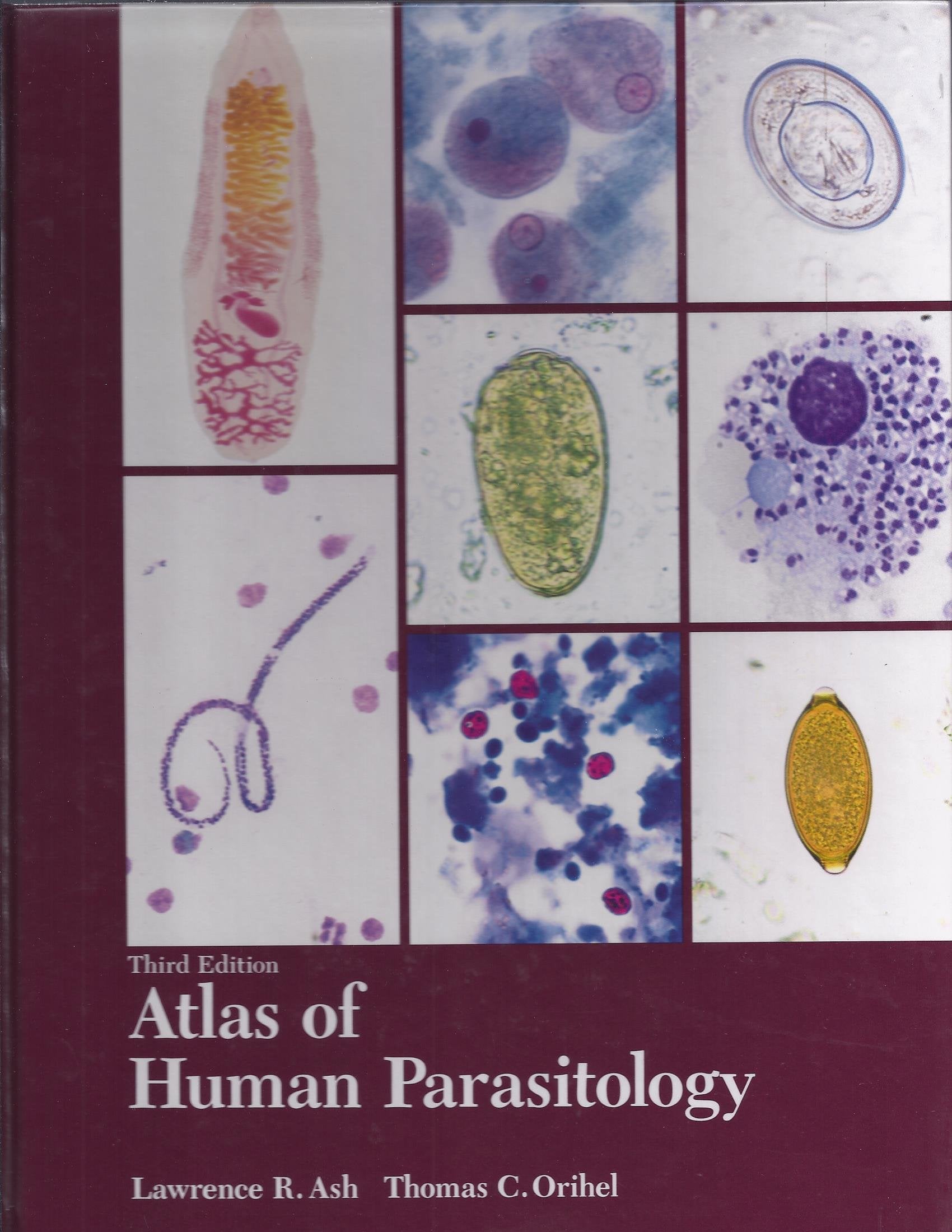Atlas of Human Parasitology Medicine