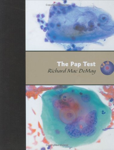 The Pap Test: Exfoliative Gynecologic Cytology Medicine