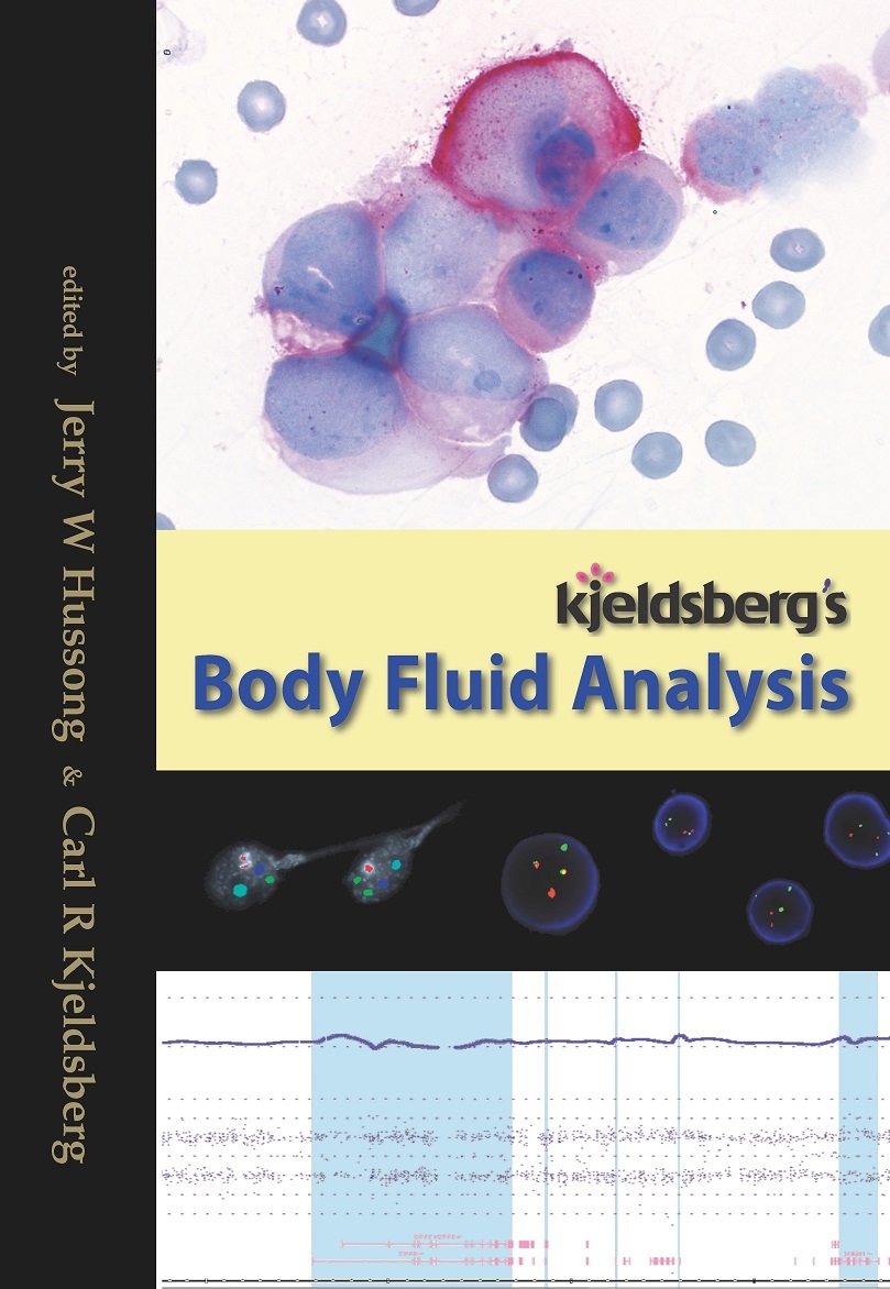 Kjeldsberg’s Body Fluid Analysis Medicine