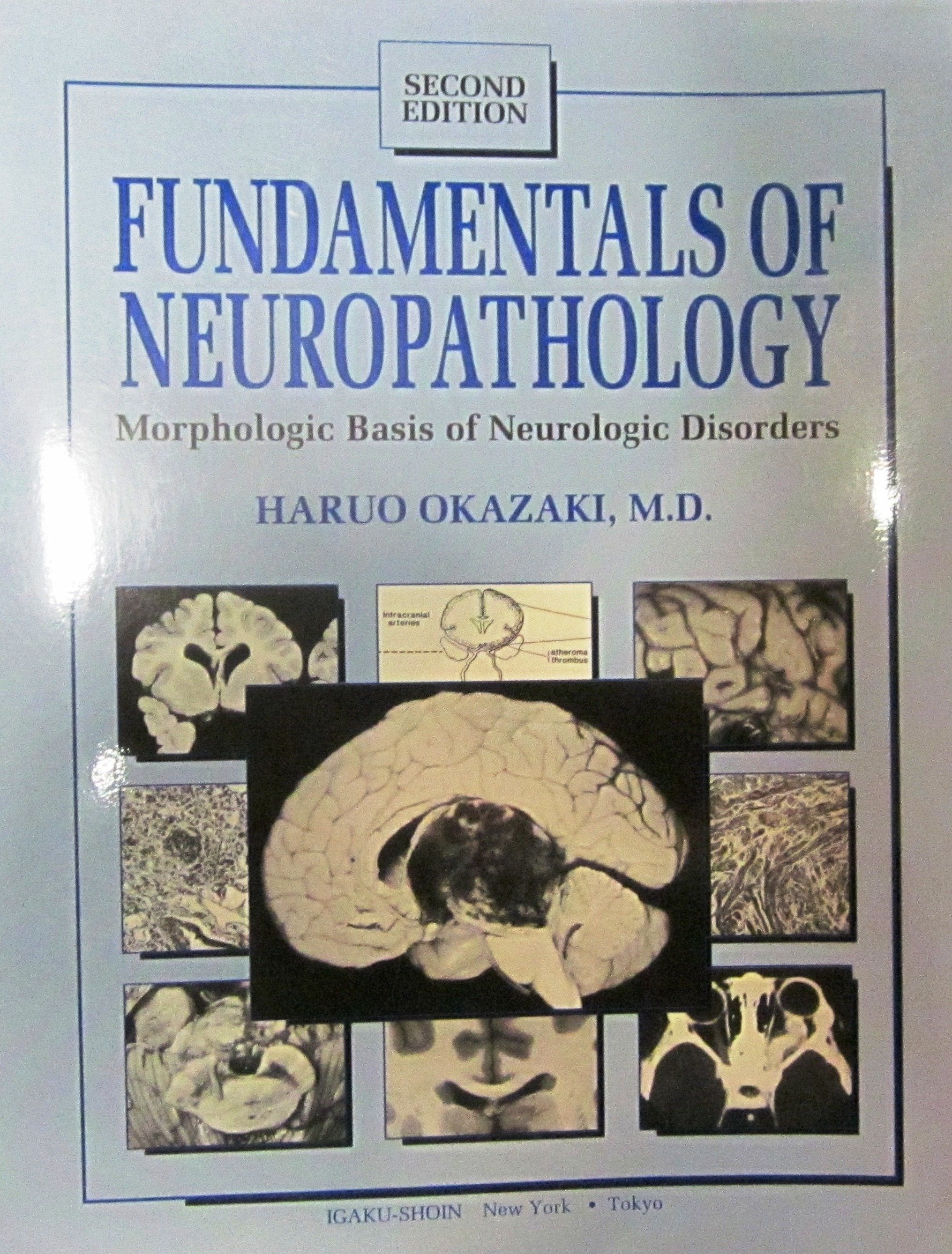 Fundamentals of Neuropathology: Morphologic Basis of Neurologic Disorders Medicine