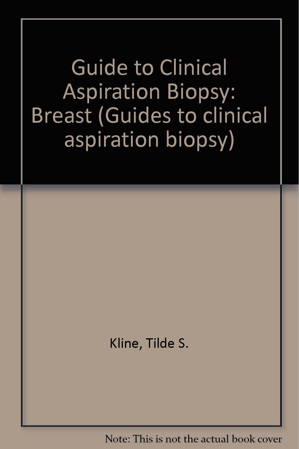 Breast (Guides to Clinical Aspiration Biopsy) Medicine