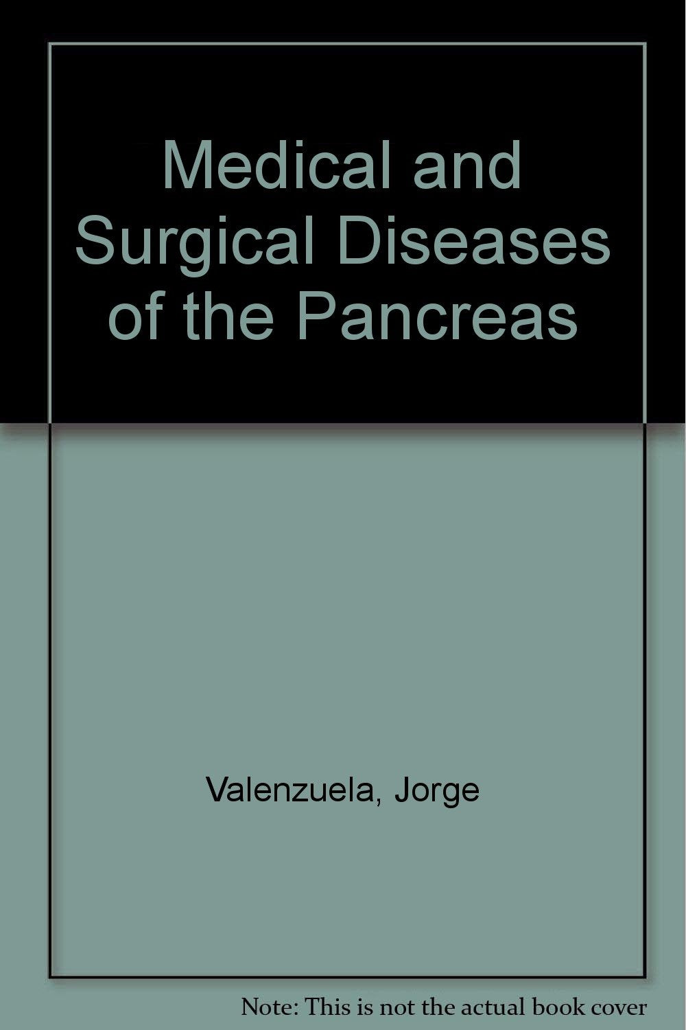 Medical and Surgical Diseases of the Pancreas Medicine