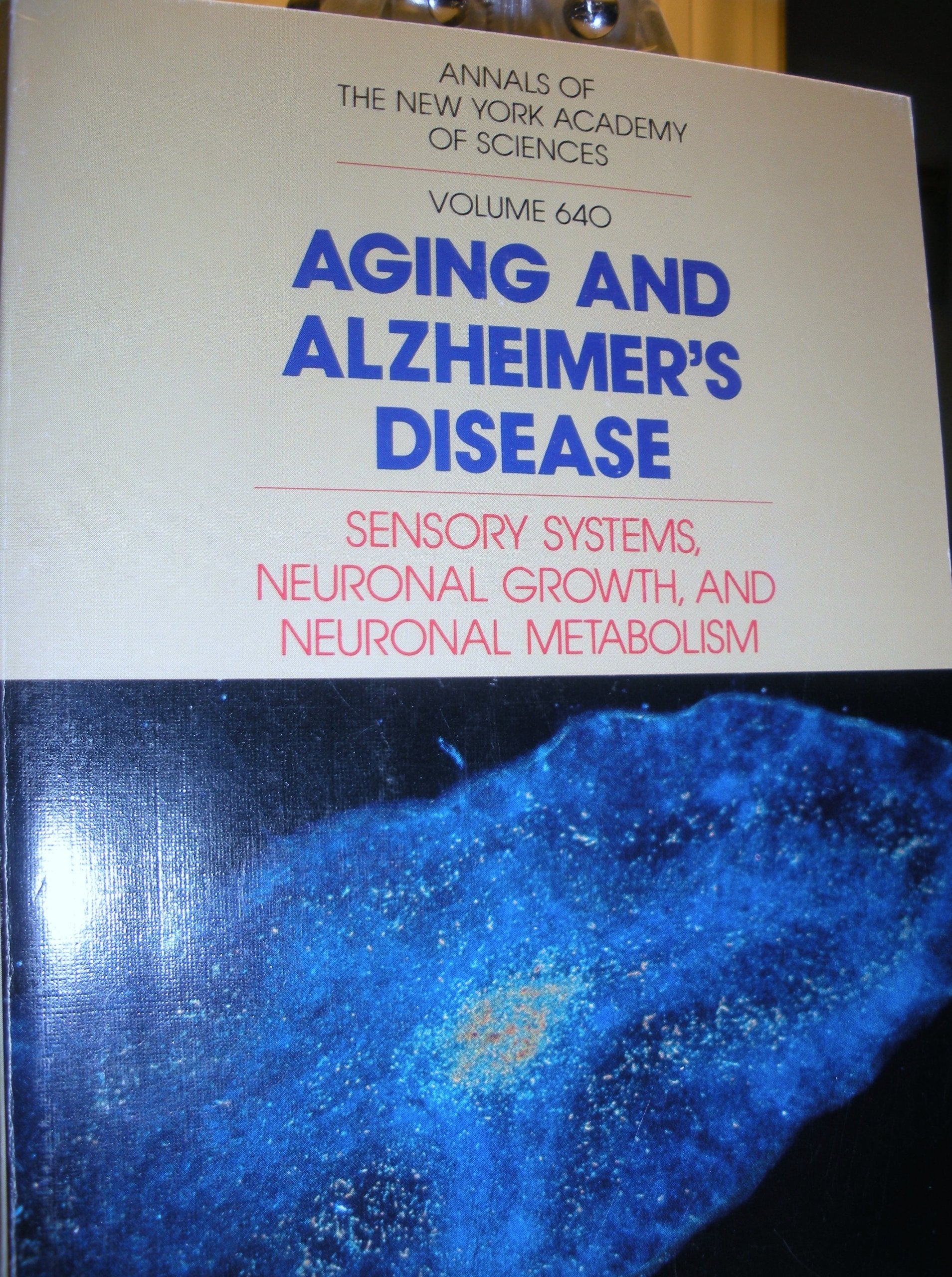 Aging and Alzheimer's Disease: Sensory Systems Neuronal Growth, and Neuronal Metabolism (Annals of the New York Academy of Sciences) Medicine