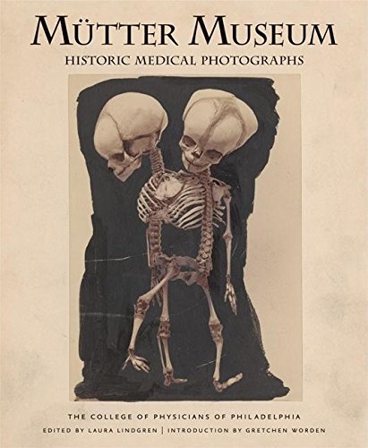 Mütter Museum Historic Medical Photographs Posters