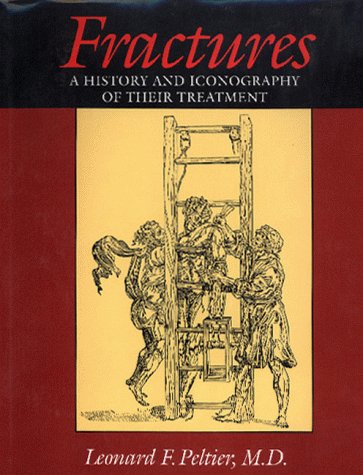 Fractures: A History and Iconography of Their Treatment Medicine
