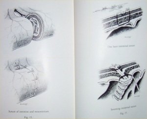 Sutures and Techniques for Wound Closure Books