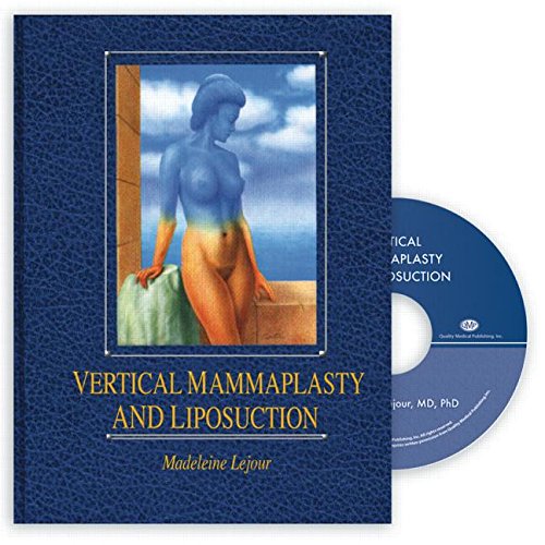 Vertical Mammaplasty and Liposuction/Book and Video book