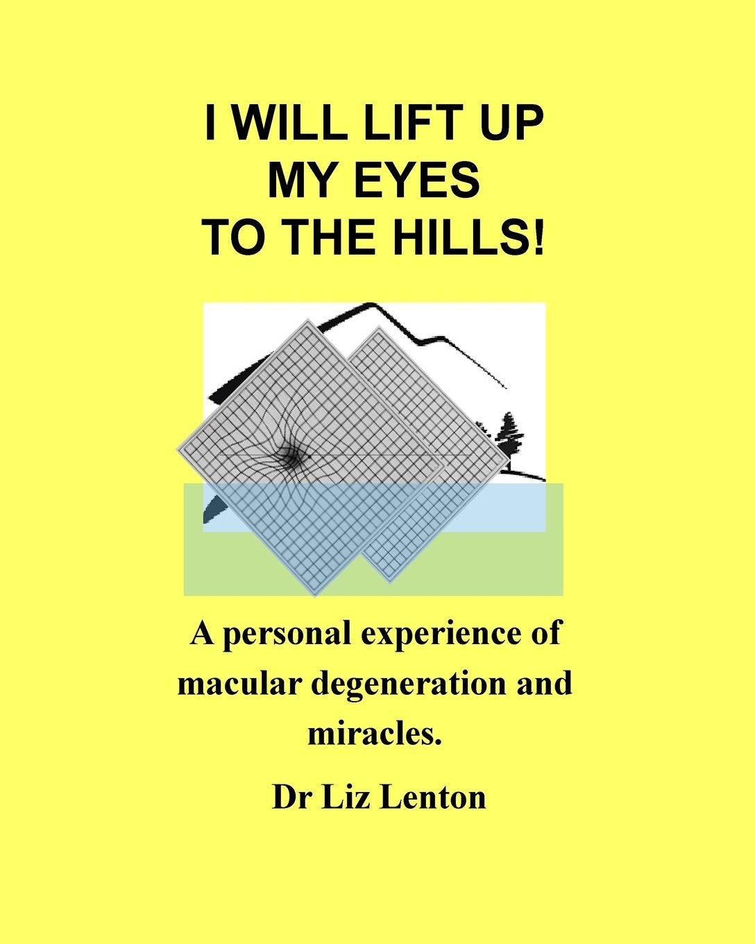 I will lift up my eyes to the hills!: A personal experience of macular degeneration and miracles (I I Will Lift Up My Eyes to the Hills!: A Personal Experience of Macular Degeneration and Miracles) Health, Nutrition & Fitness