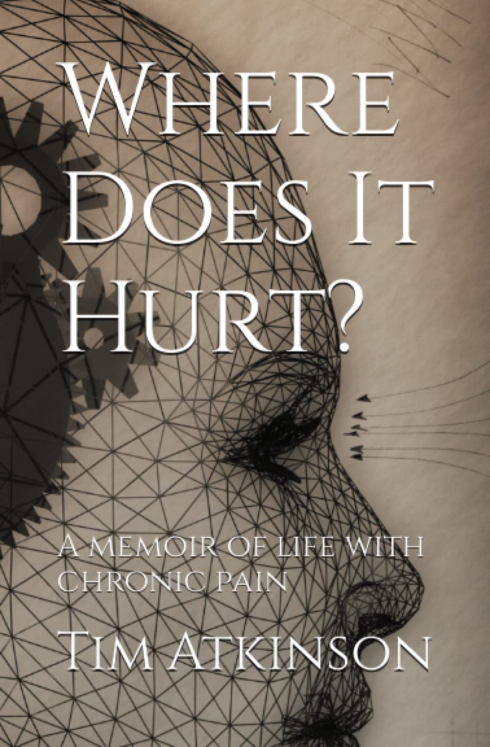 Where Does It Hurt?: A memoir of life with chronic pain Science