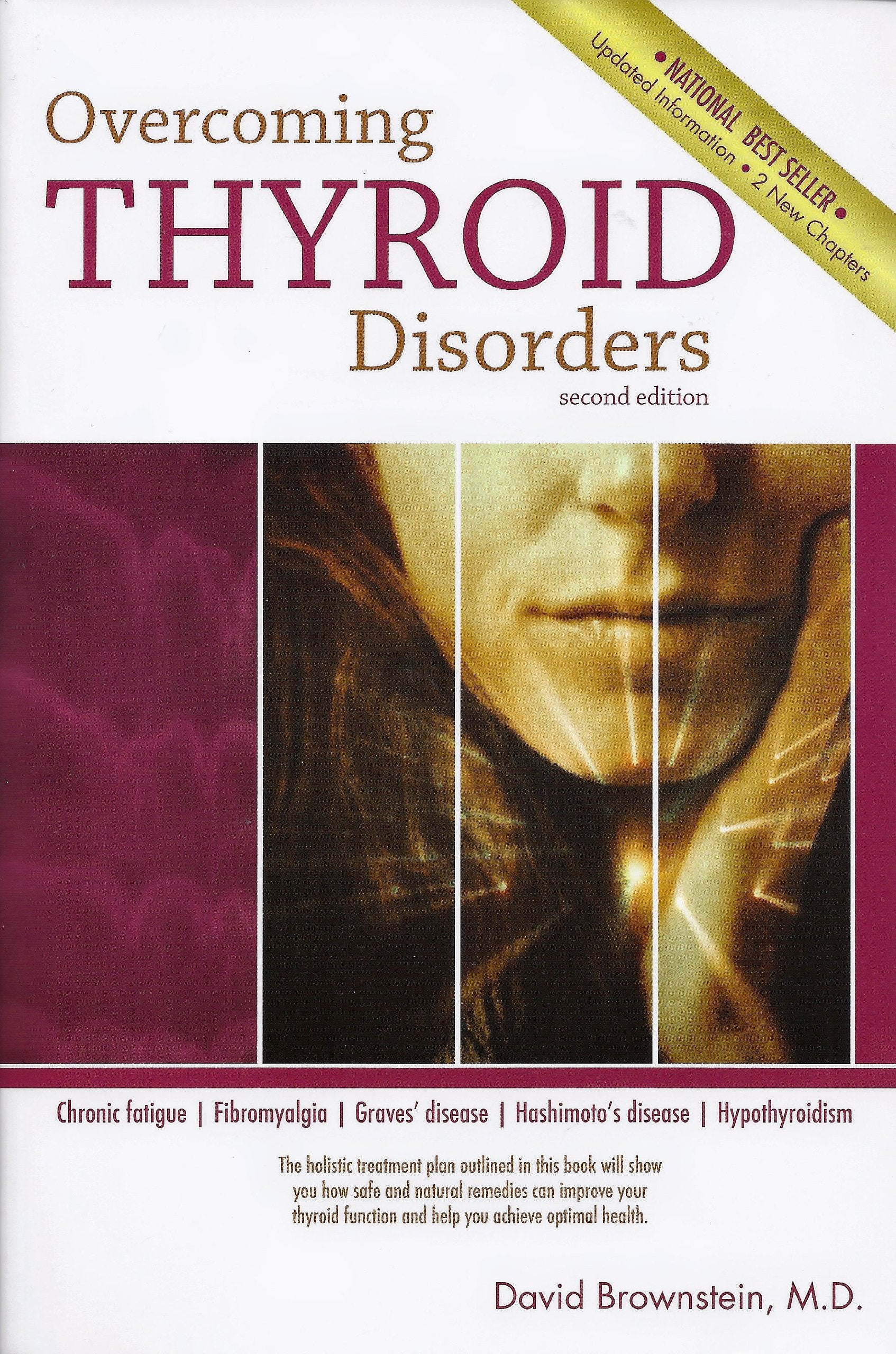 Overcoming Thyroid Disorders by Brownstein, David (2002) Paperback Medicine Books