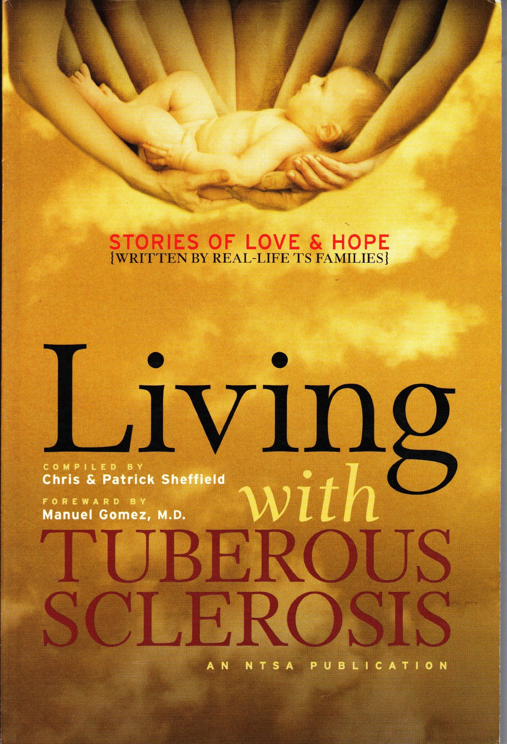 Living with Tuberous Sclerosis (Stories of Hope and Love) Books