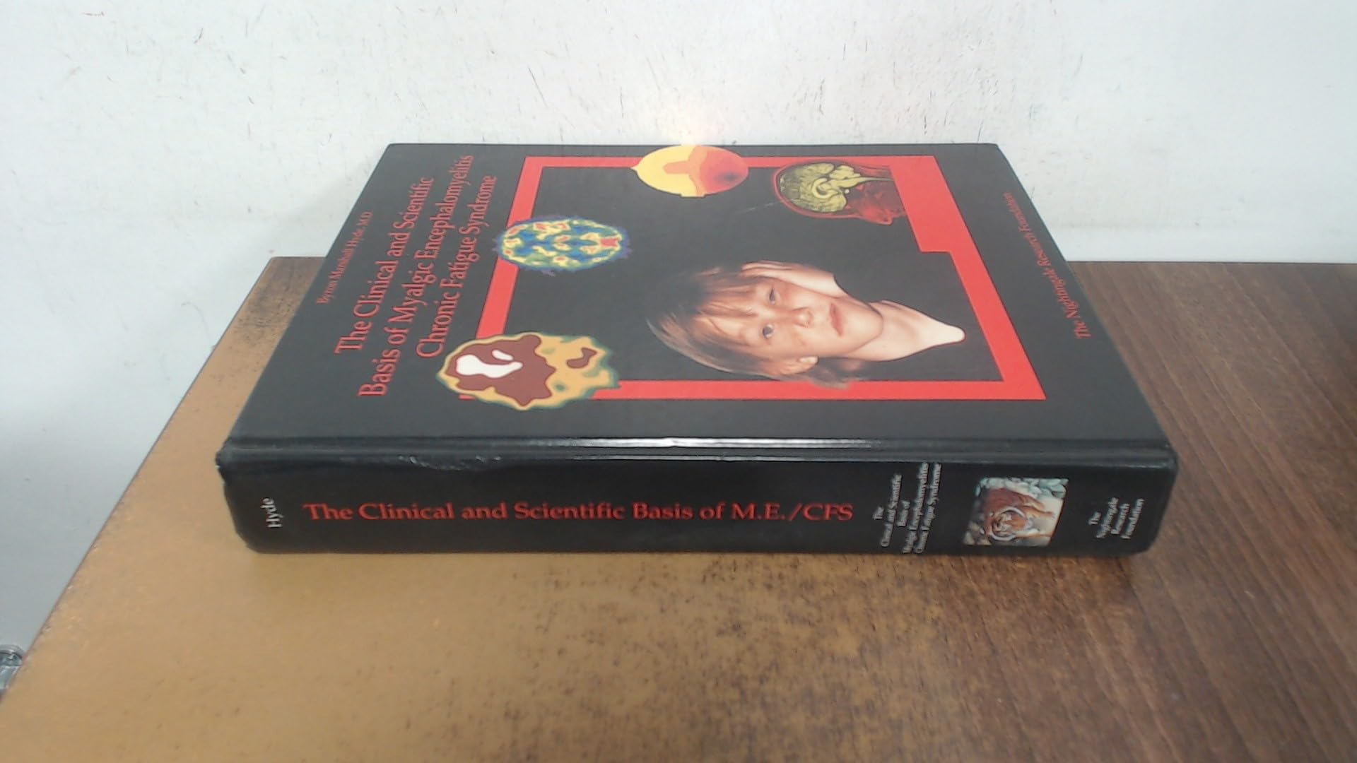 The Clinical and Scientific Basis of Myalgic Encephalomyelitis--Chronic Fatigue Syndrome Books
