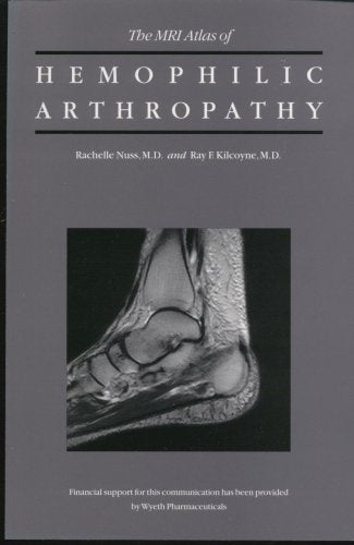 The MRI atlas of hemophilic arthropathy Books