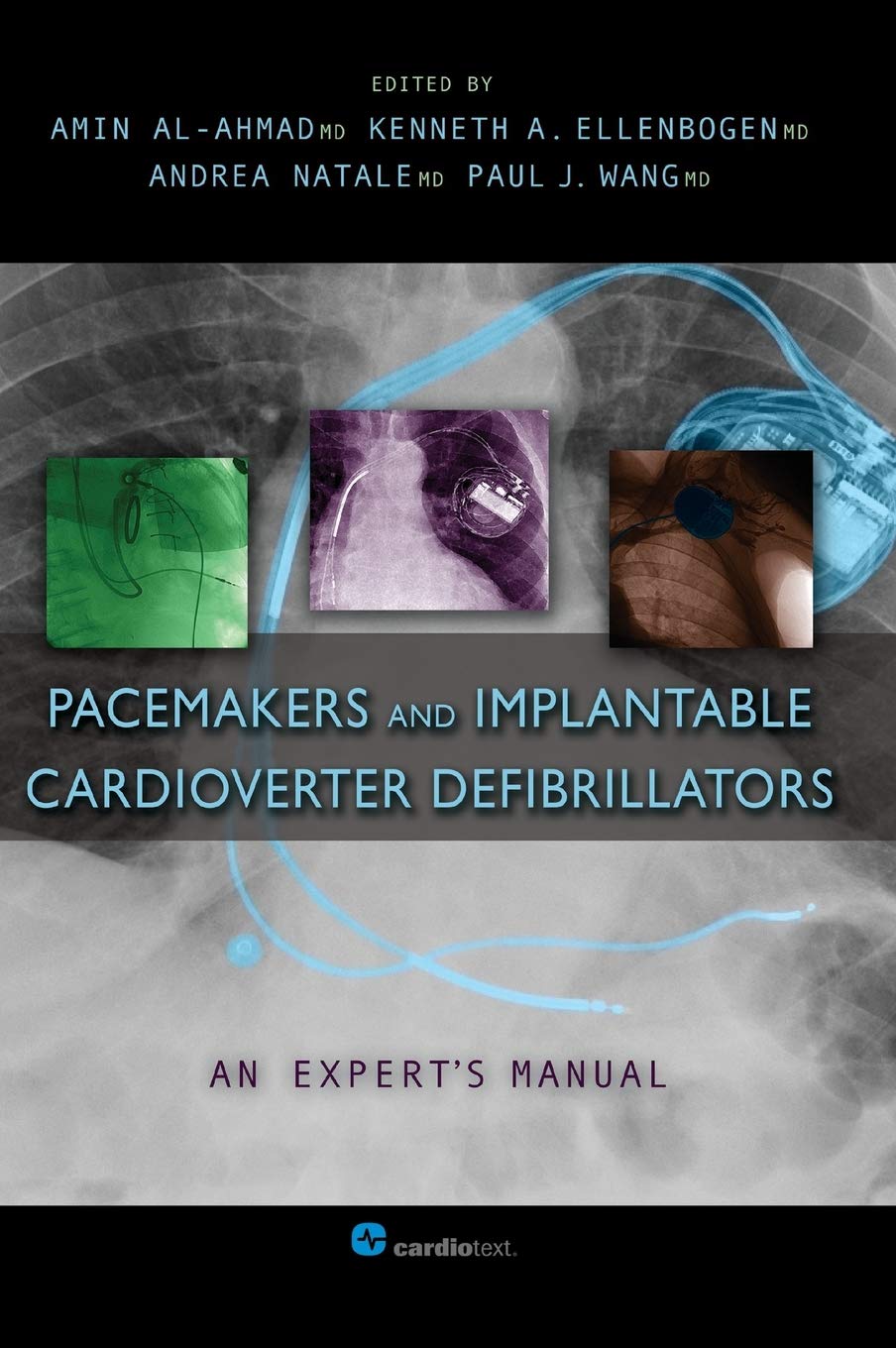 Pacemakers and Implantable Cardioverter Defibrillators: An Expert's Manual book