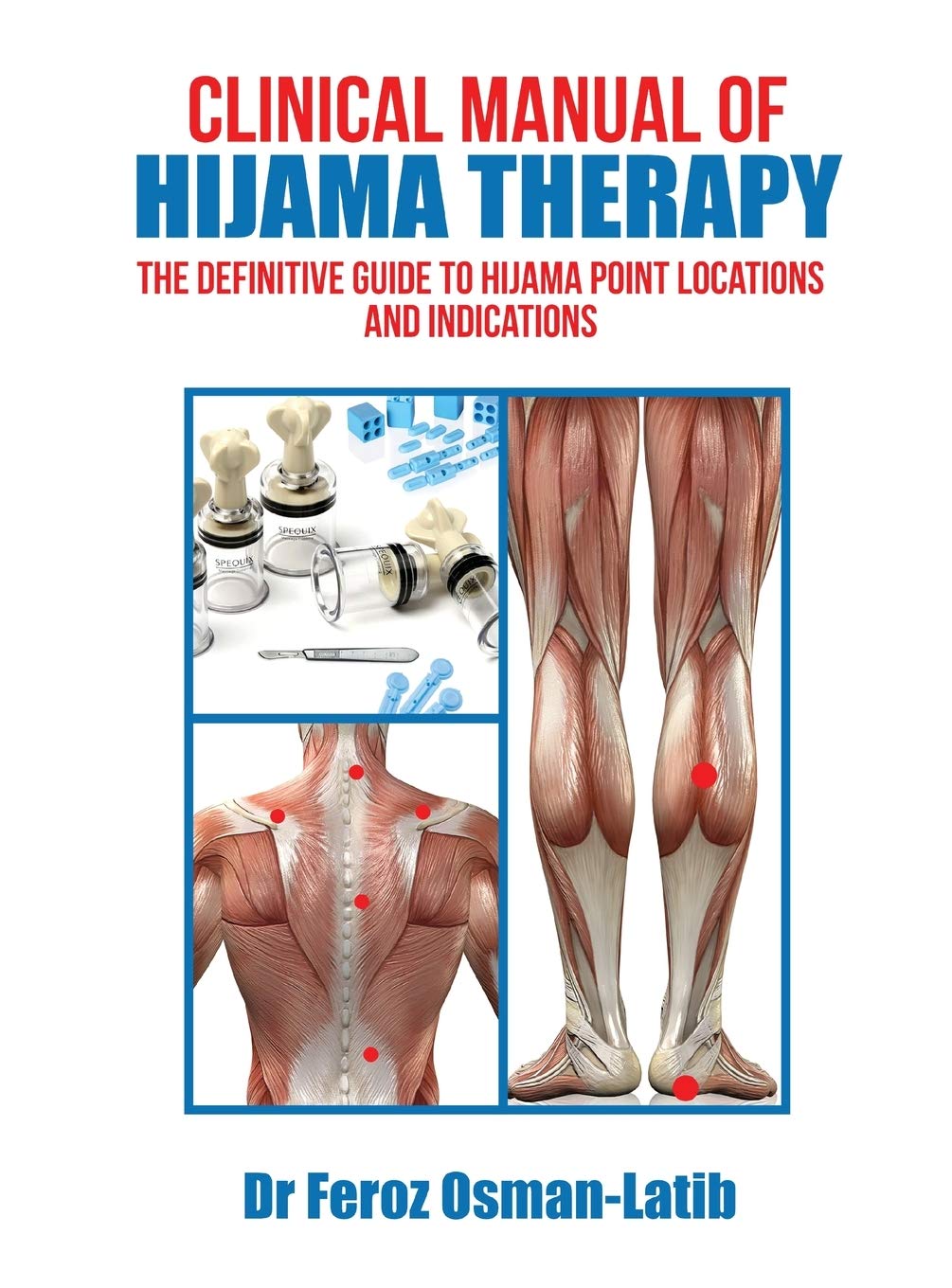 Clinical Manual of Hijama Therapy: The Definitive Guide to Hijama Point Locations and Indications Medicine