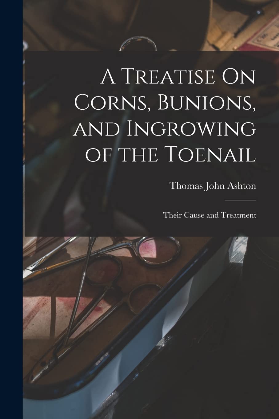 A Treatise On Corns, Bunions, and Ingrowing of the Toenail: Their Cause and Treatment Medicine