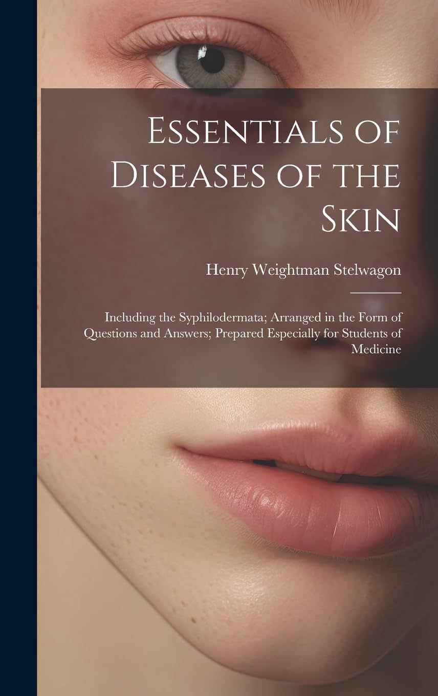 Essentials of Diseases of the Skin: Including the Syphilodermata; Arranged in the Form of Questions and Answers; Prepared Especially for Students of Medicine Medicine