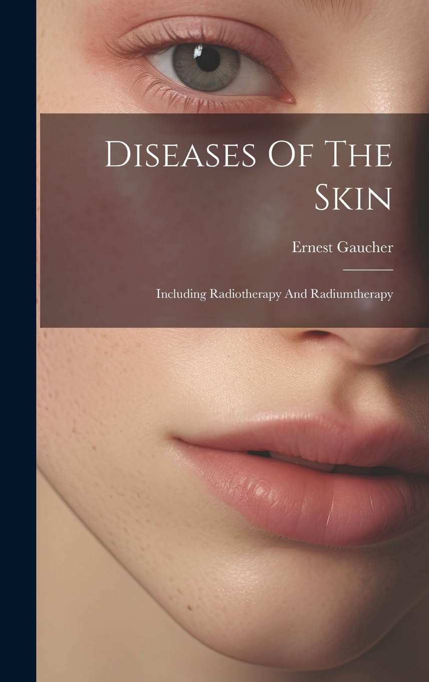 Diseases Of The Skin: Including Radiotherapy And Radiumtherapy Medicine