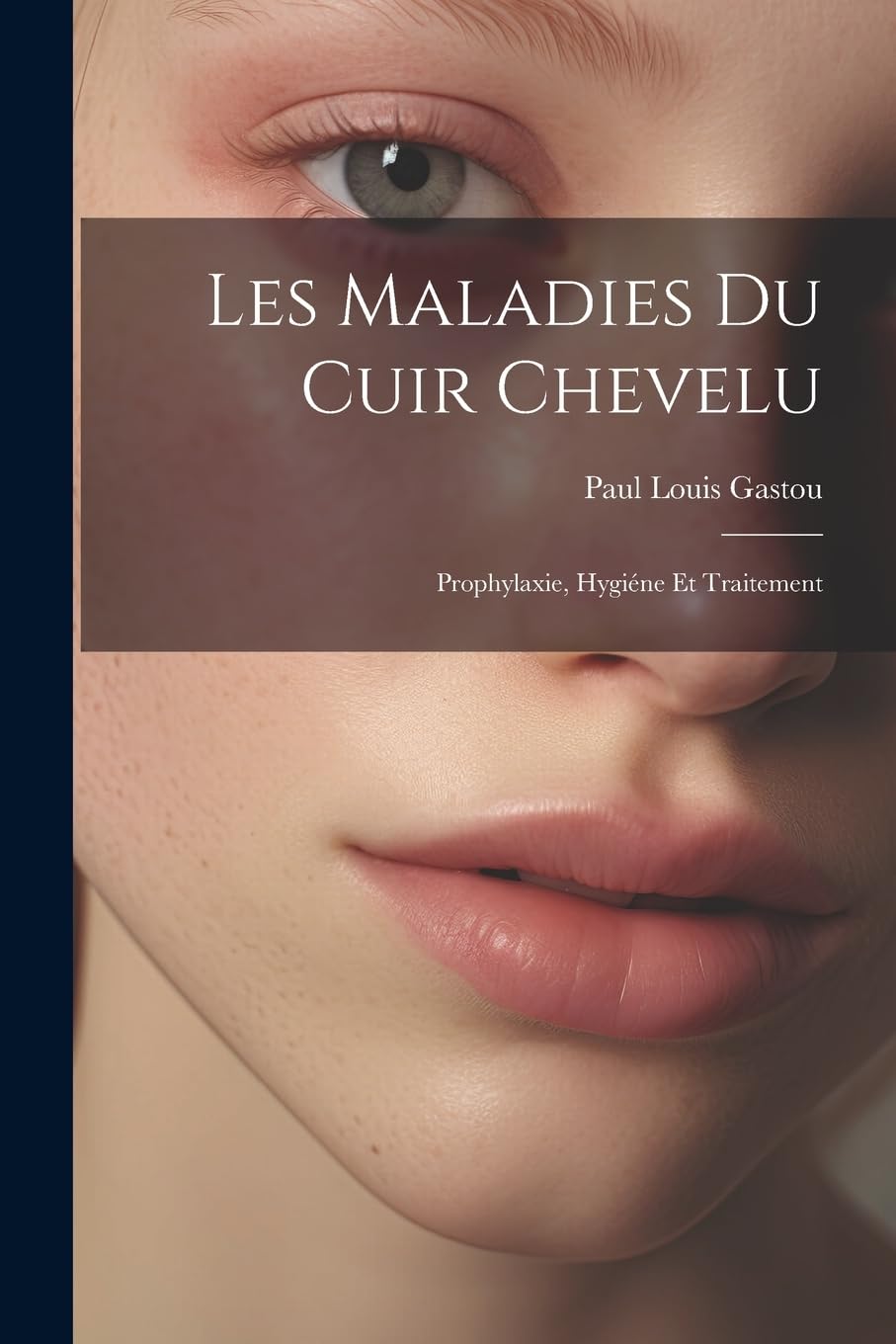 Les Maladies Du Cuir Chevelu: Prophylaxie, Hygiéne Et Traitement book