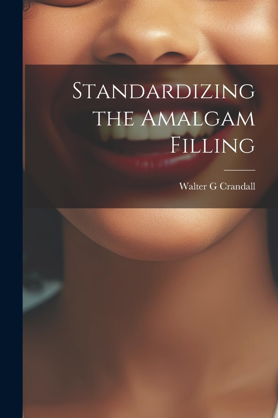 Product Image: Standardizing the Amalgam Filling