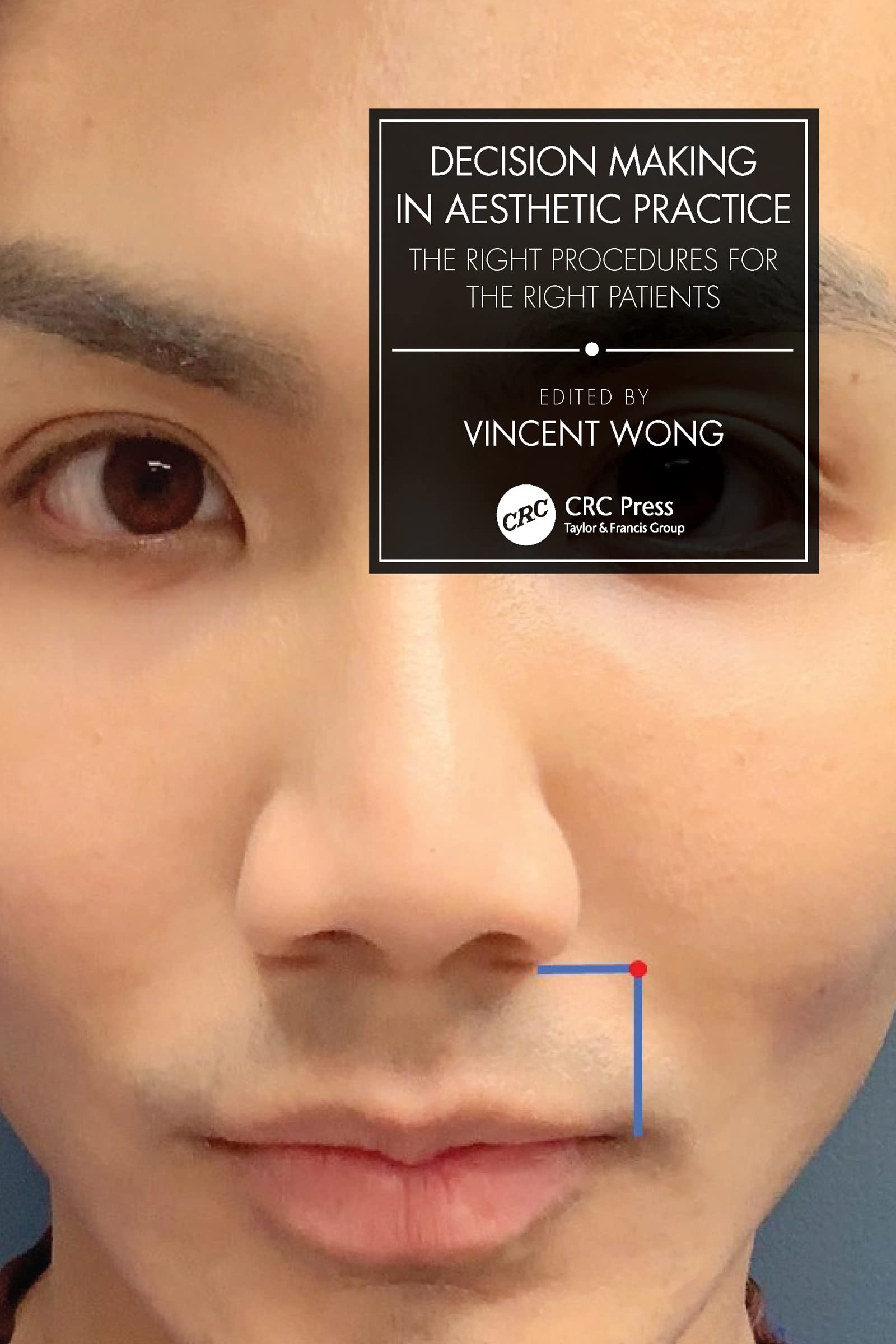 Decision Making in Aesthetic Practice: The Right Procedures for the Right Patients Medicine