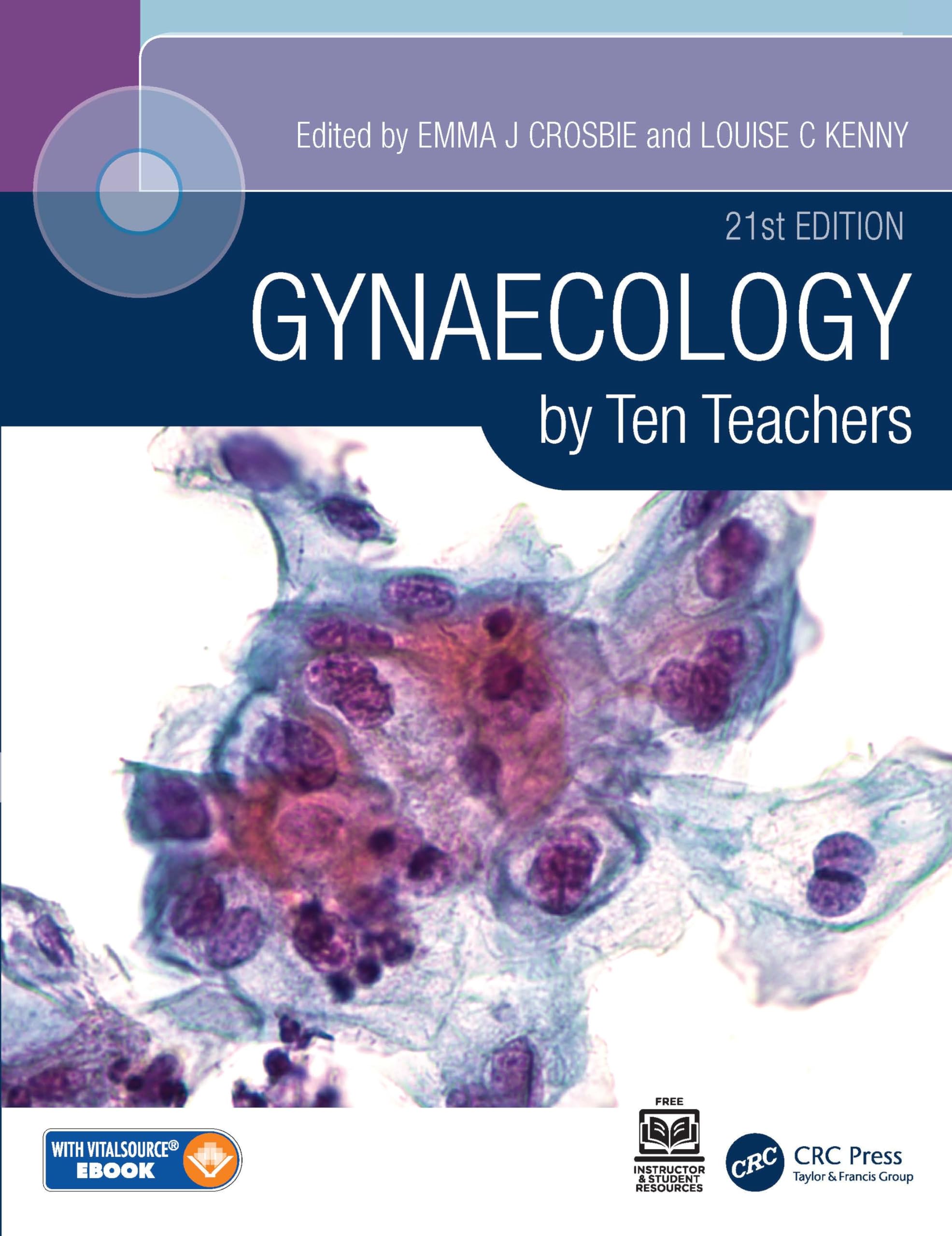 Gynaecology by Ten Teachers Medicine