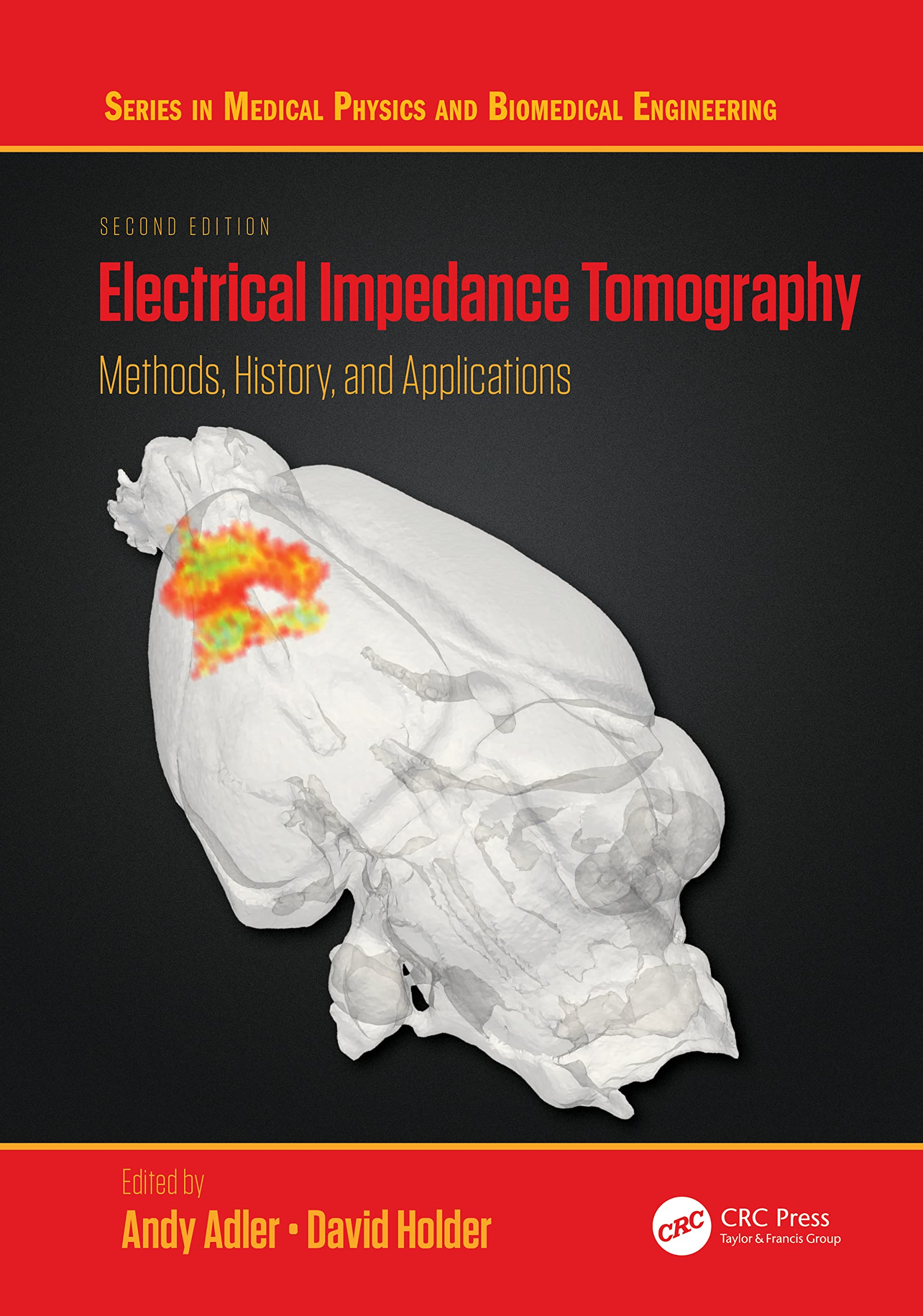 Electrical Impedance Tomography: Methods, History and Applications (In Medical Physics and Biomedical Engineering) Medicine