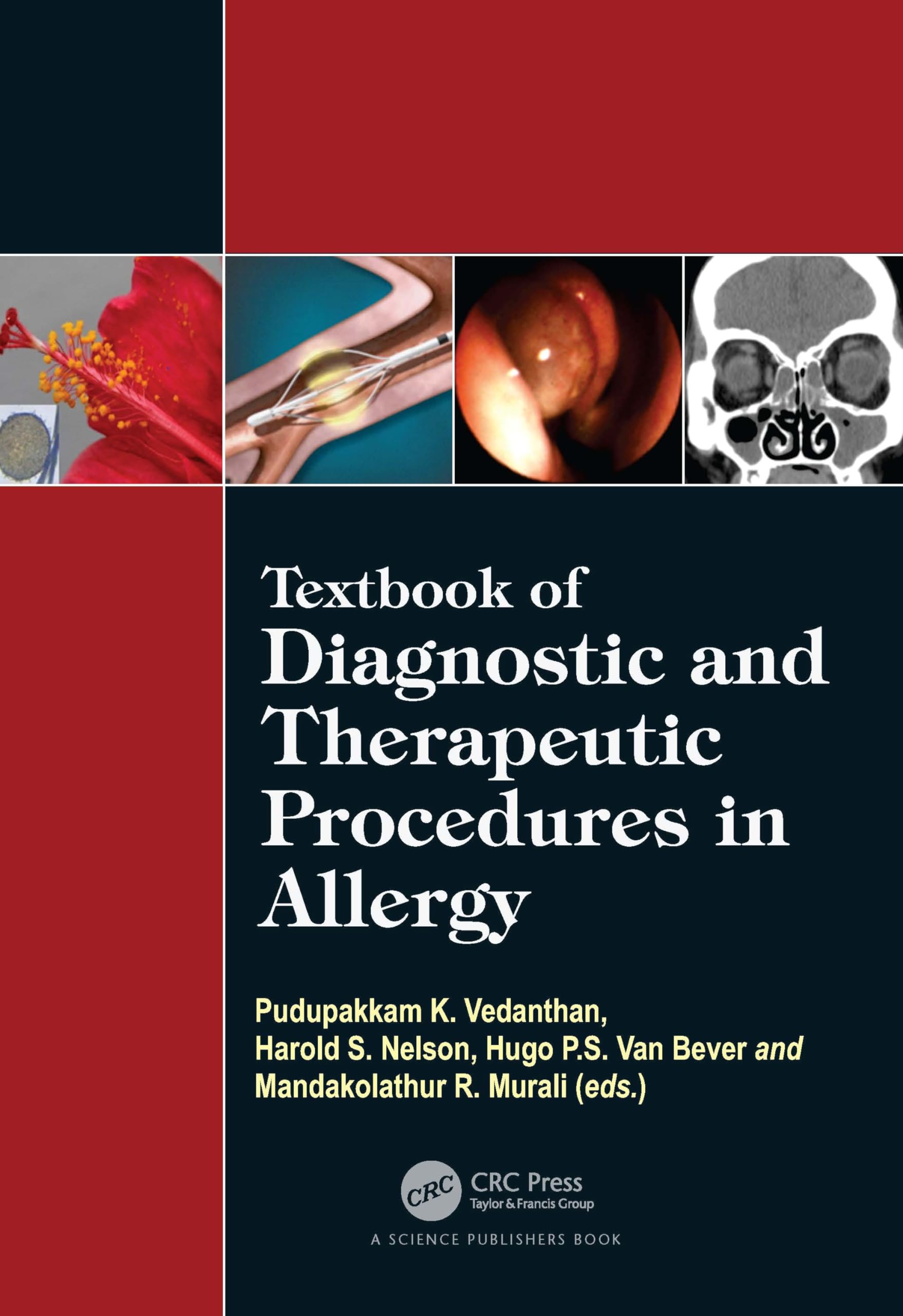 Textbook of Diagnostic and Therapeutic Procedures in Allergy Medicine