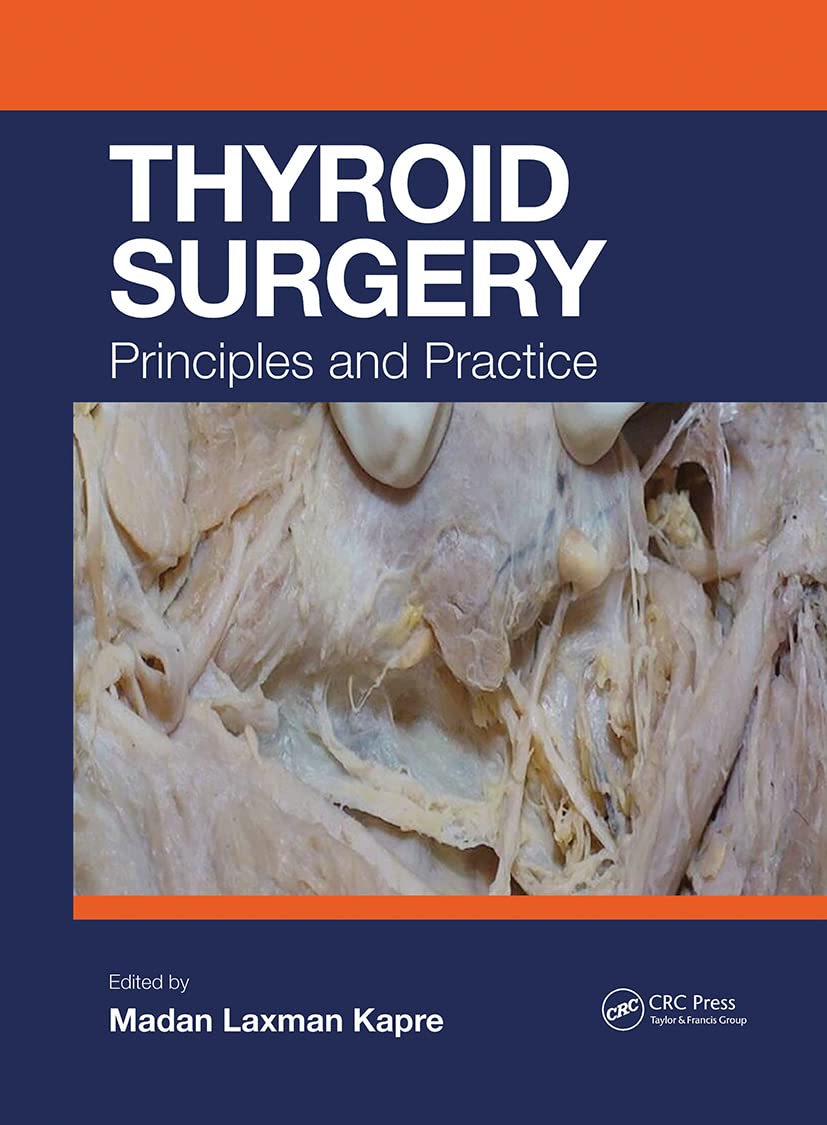 Product Image: Thyroid Surgery: Principles and Practice