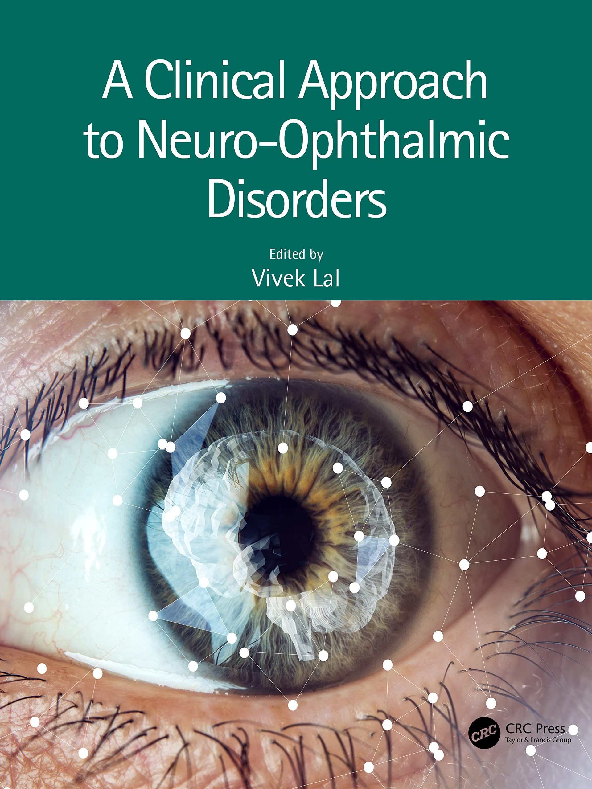 A Clinical Approach to Neuro-Ophthalmic Disorders Medicine