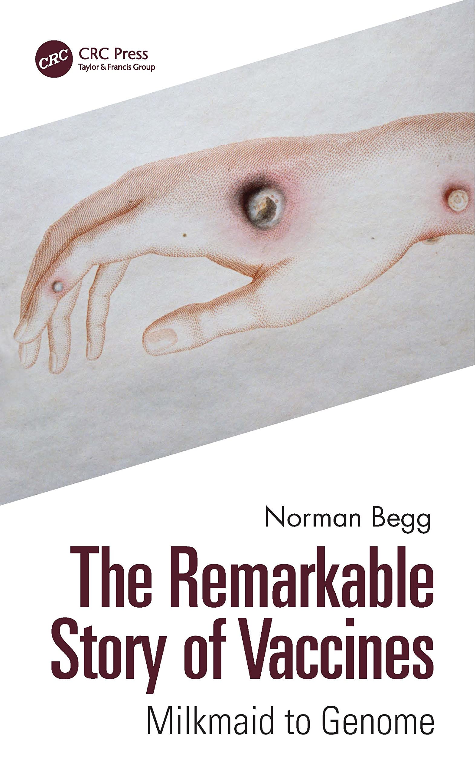 The Remarkable Story of Vaccines Medicine