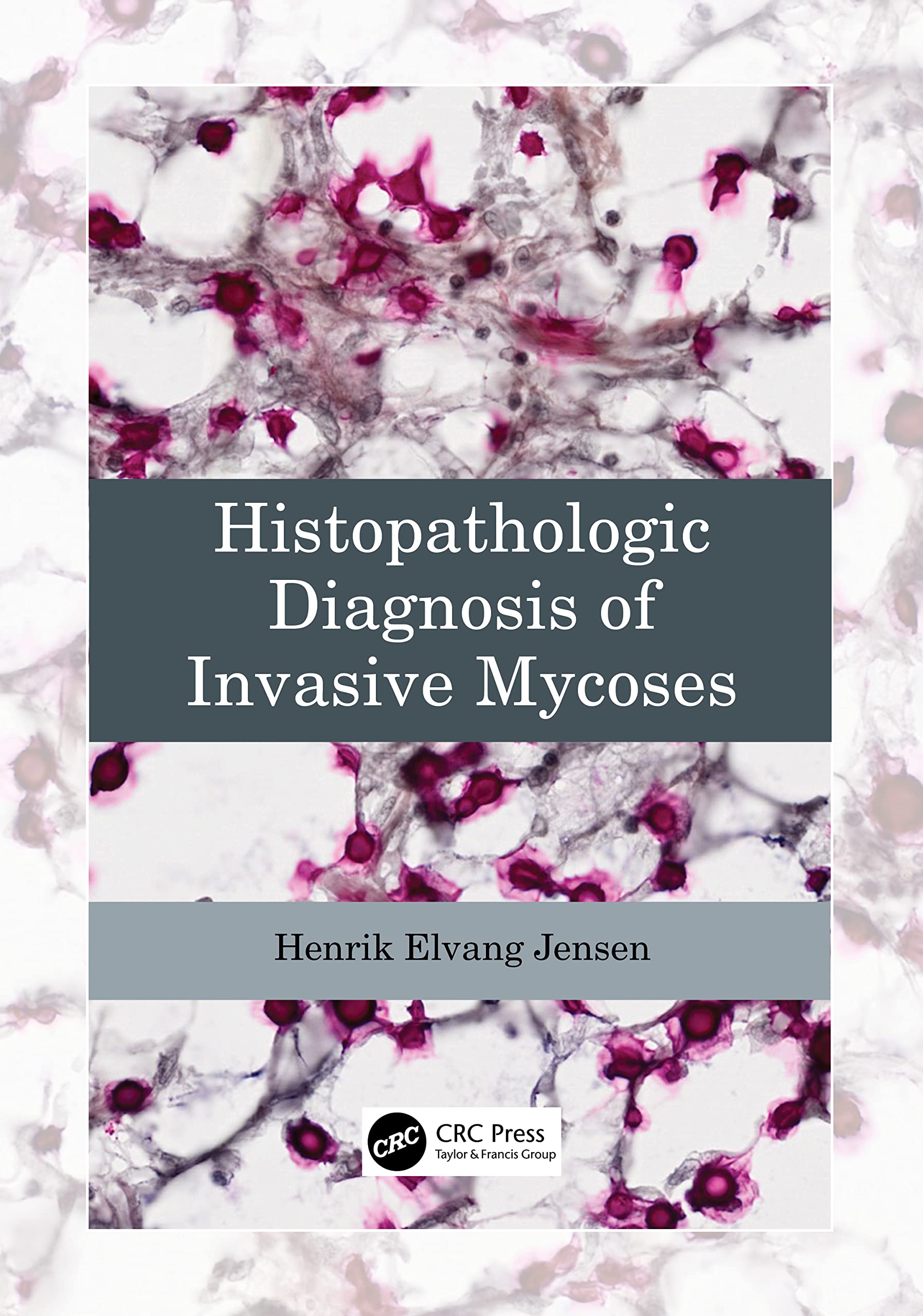 Histopathologic Diagnosis of Invasive Mycoses Medicine