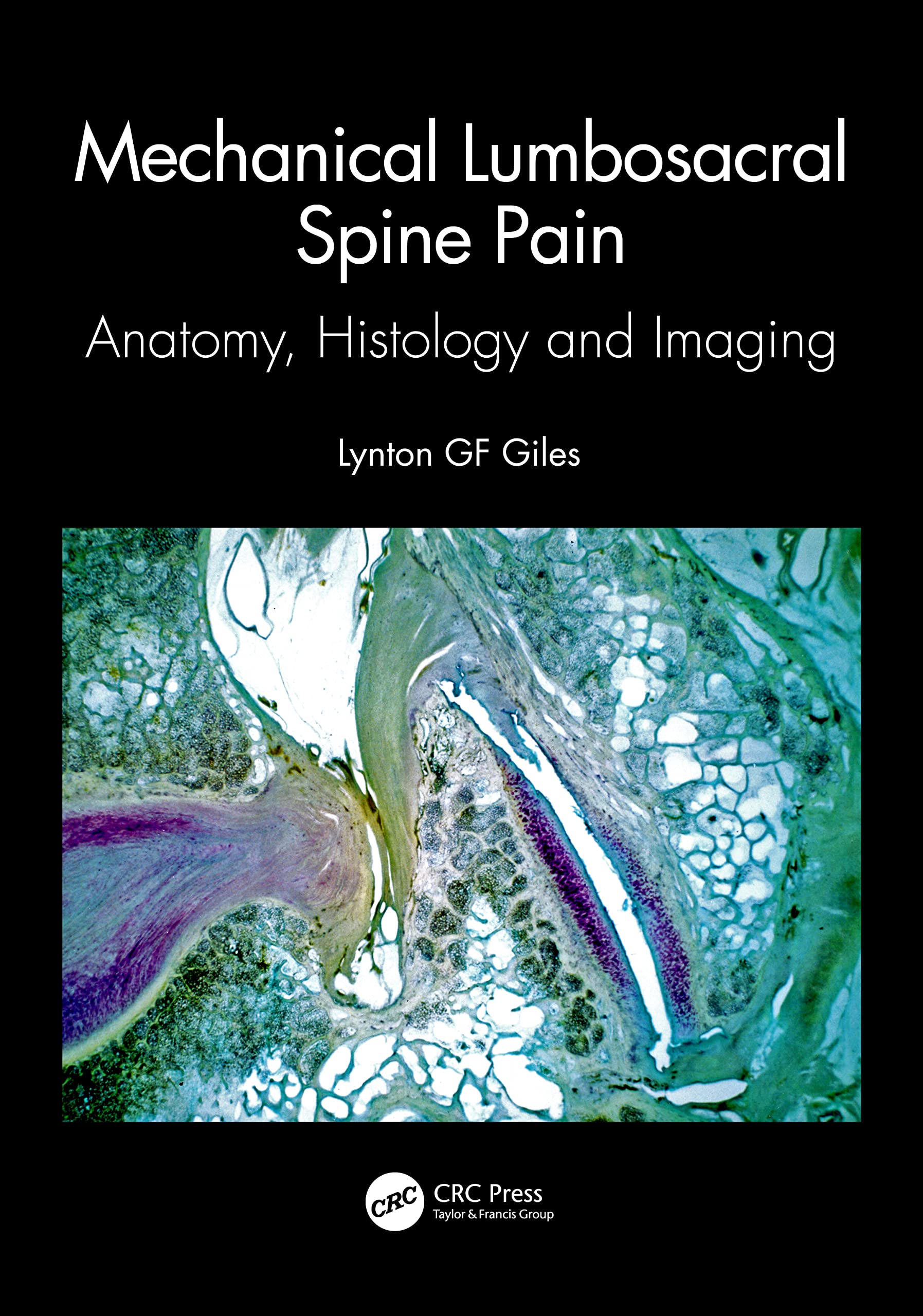 Mechanical Lumbosacral Spine Pain: Anatomy, Histology and Imaging Medicine