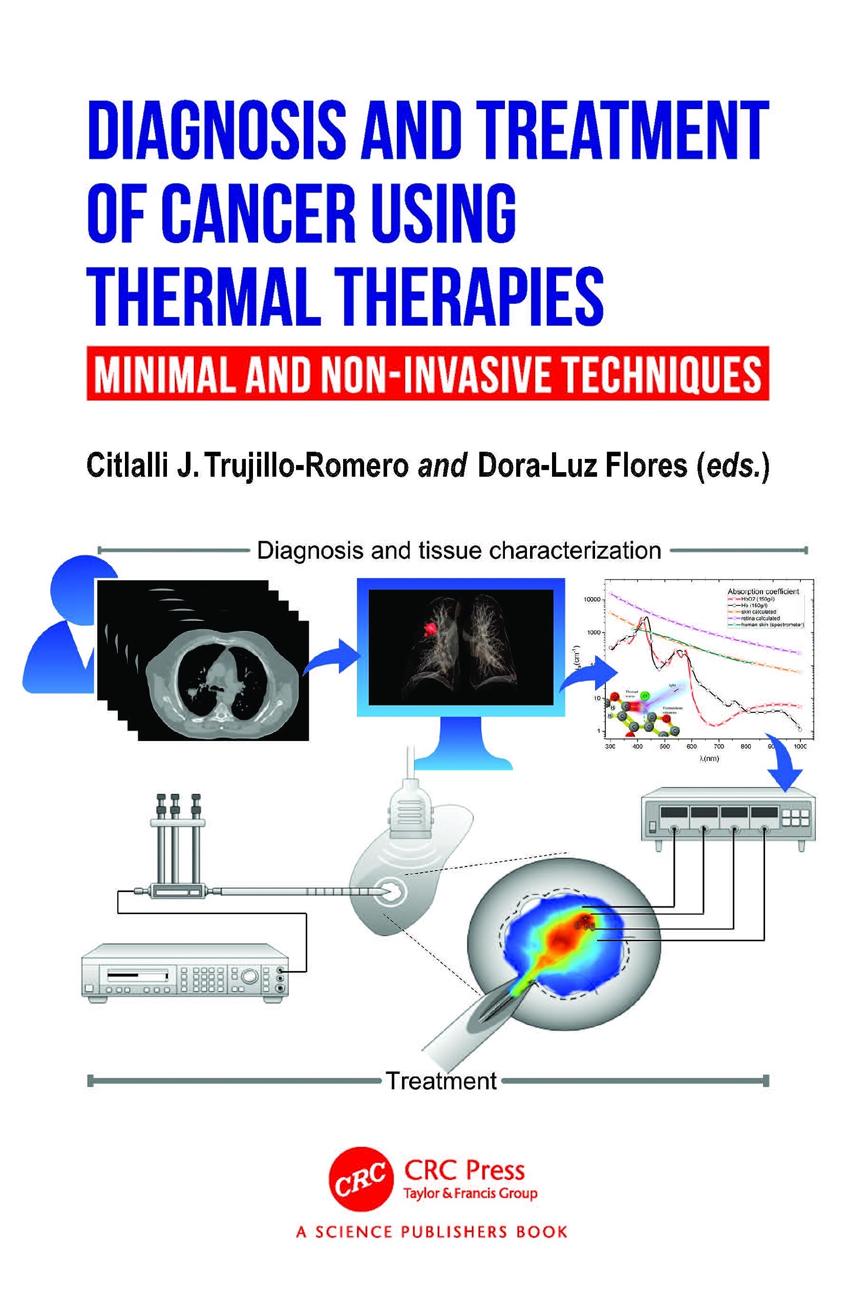 Diagnosis and Treatment of Cancer using Thermal Therapies Medicine