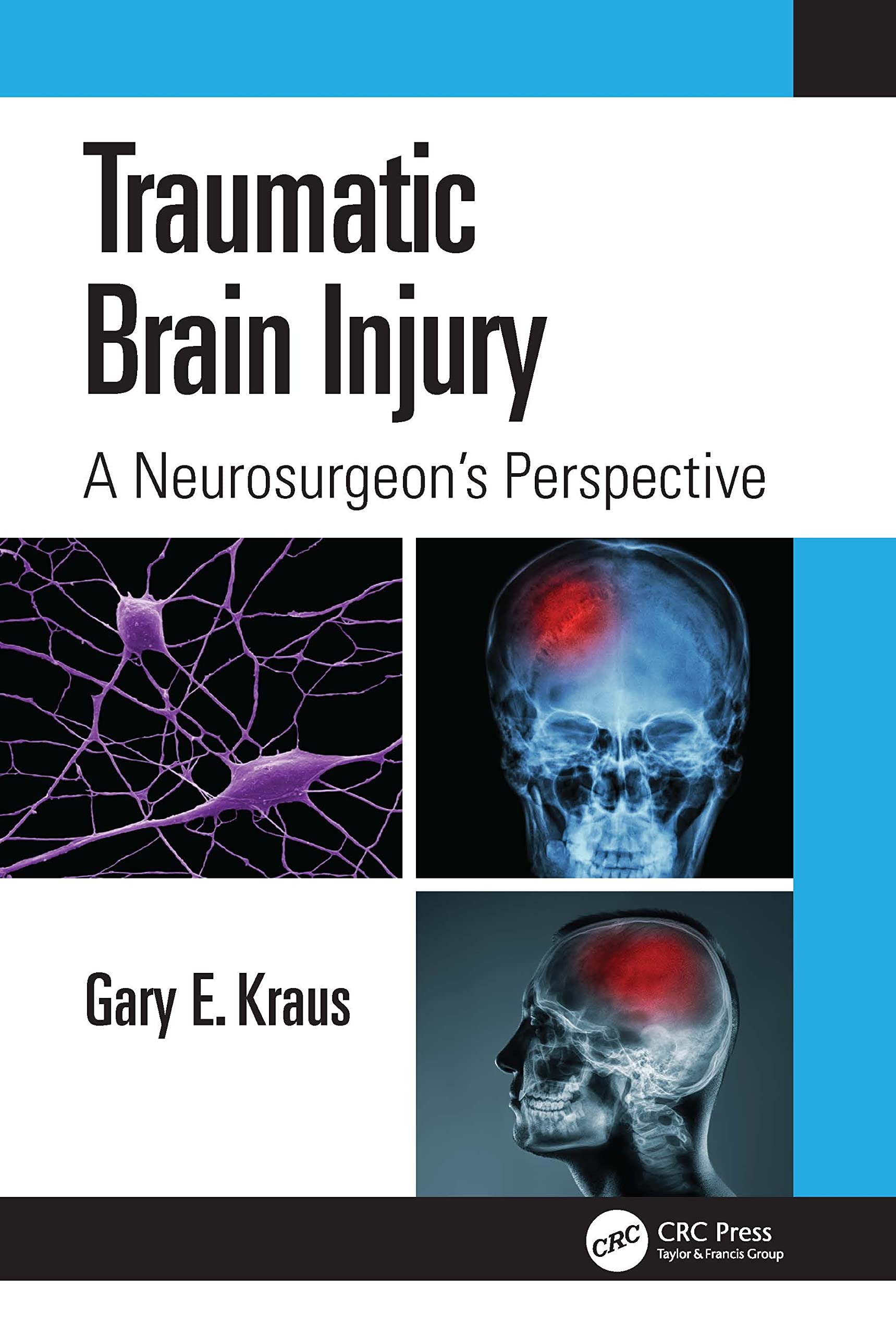 Traumatic Brain Injury Medicine