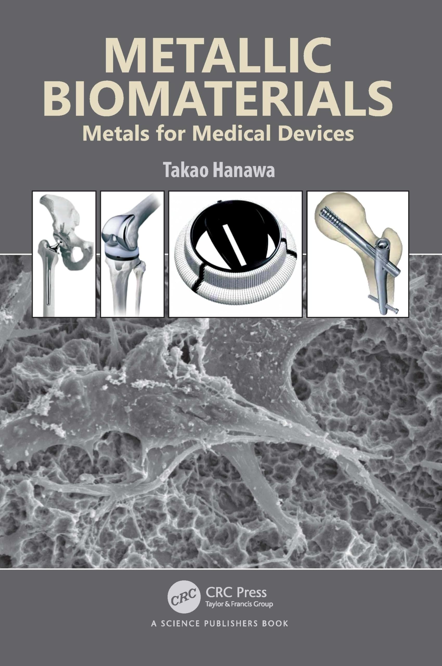 Product Image: Metallic Biomaterials