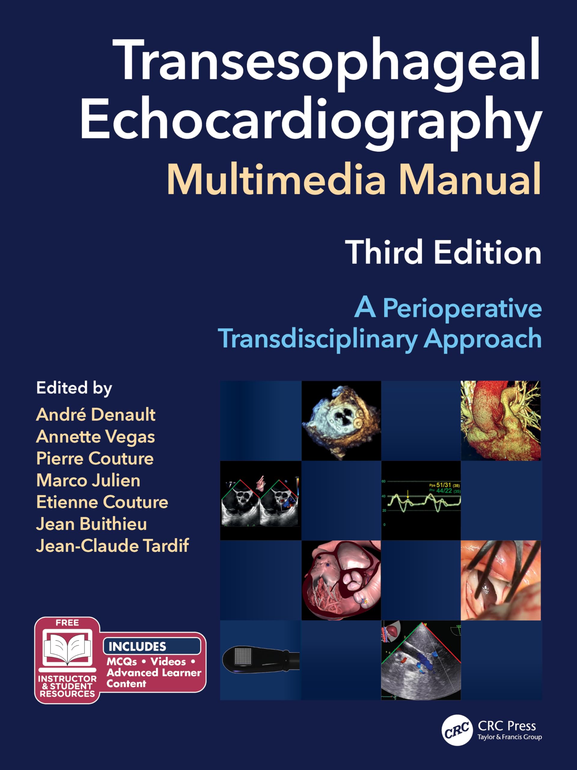 Transesophageal Echocardiography Multimedia Manual: A Perioperative Transdisciplinary Approach Medicine
