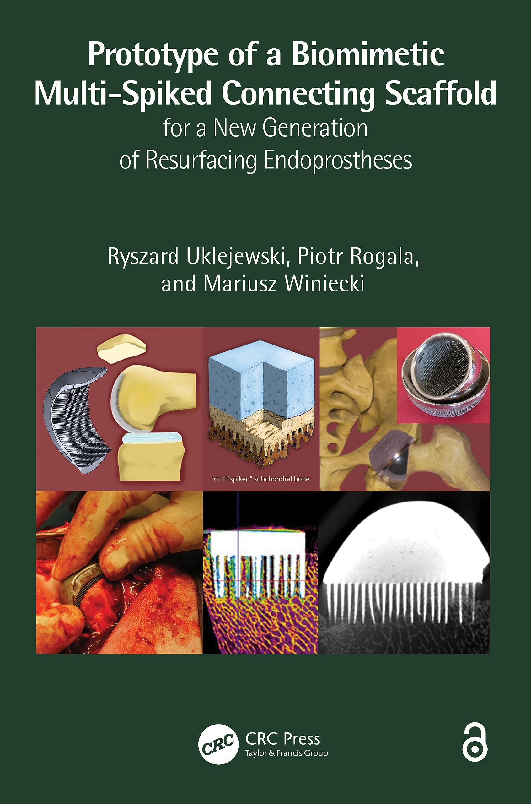 Prototype of a Biomimetic Multi-Spiked Connecting Scaffold for a New Generation of Resurfacing Endoprostheses Medicine