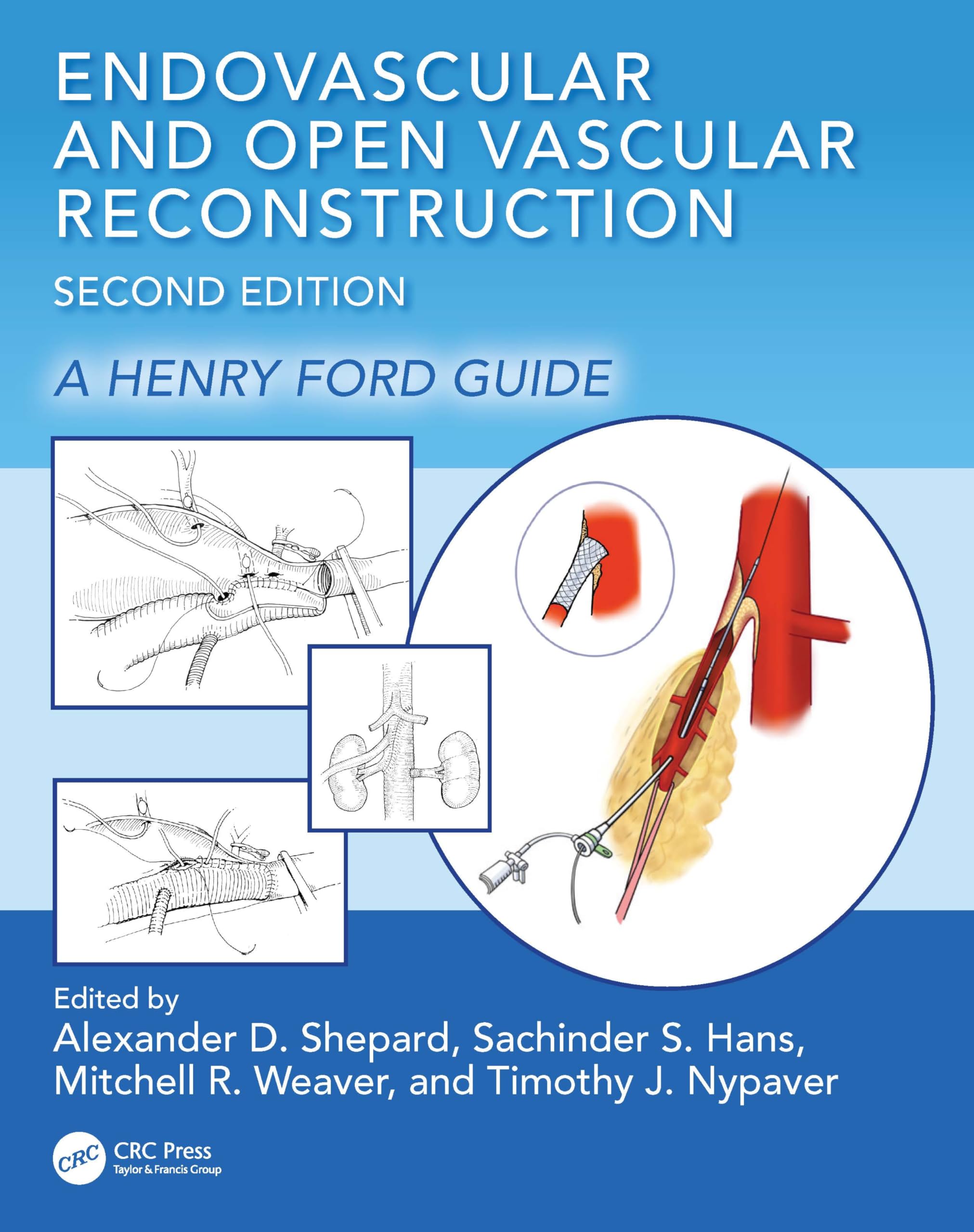 Endovascular and Open Vascular Reconstruction: A Henry Ford Surgical Guide Medicine