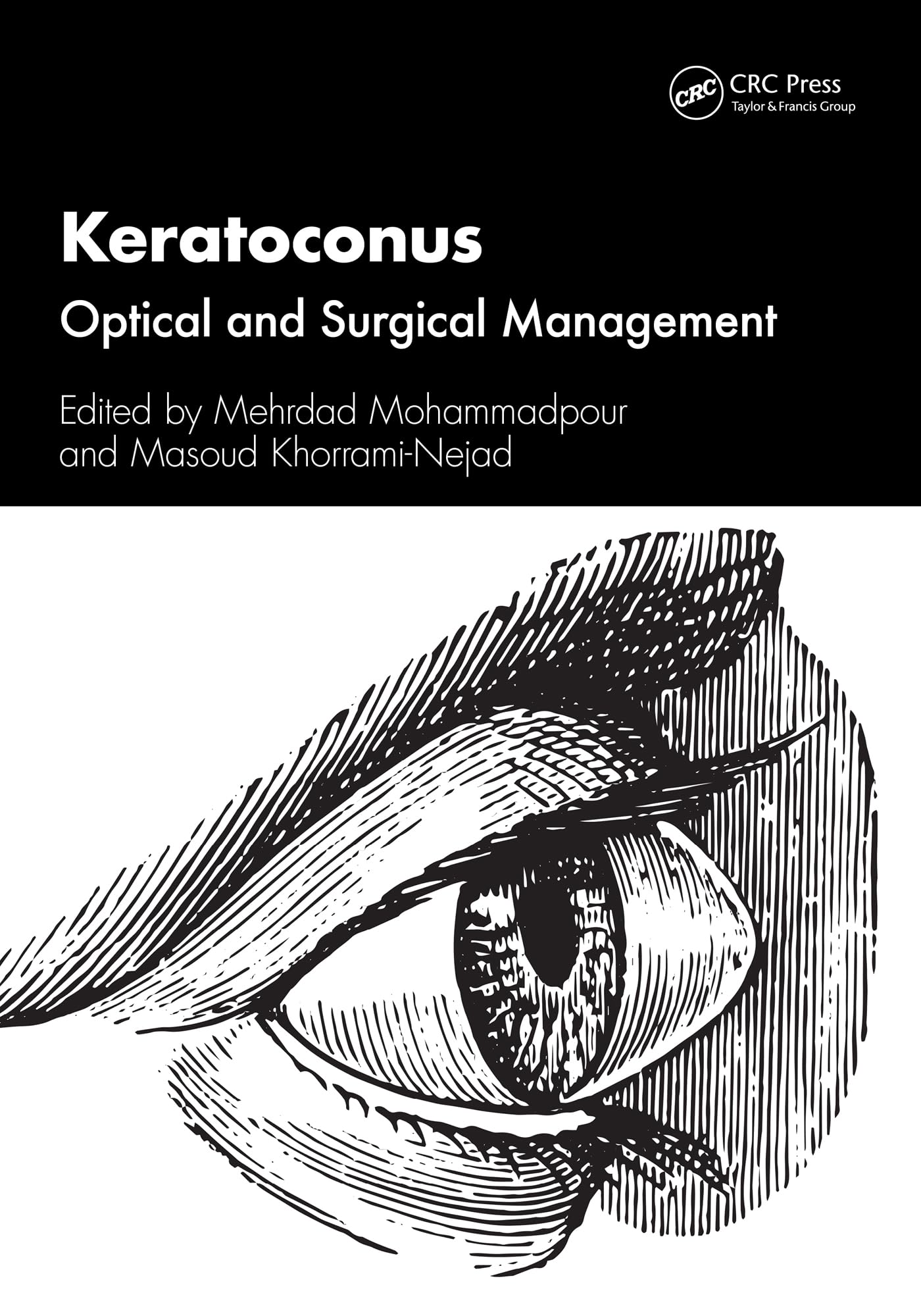 Keratoconus Medicine Books