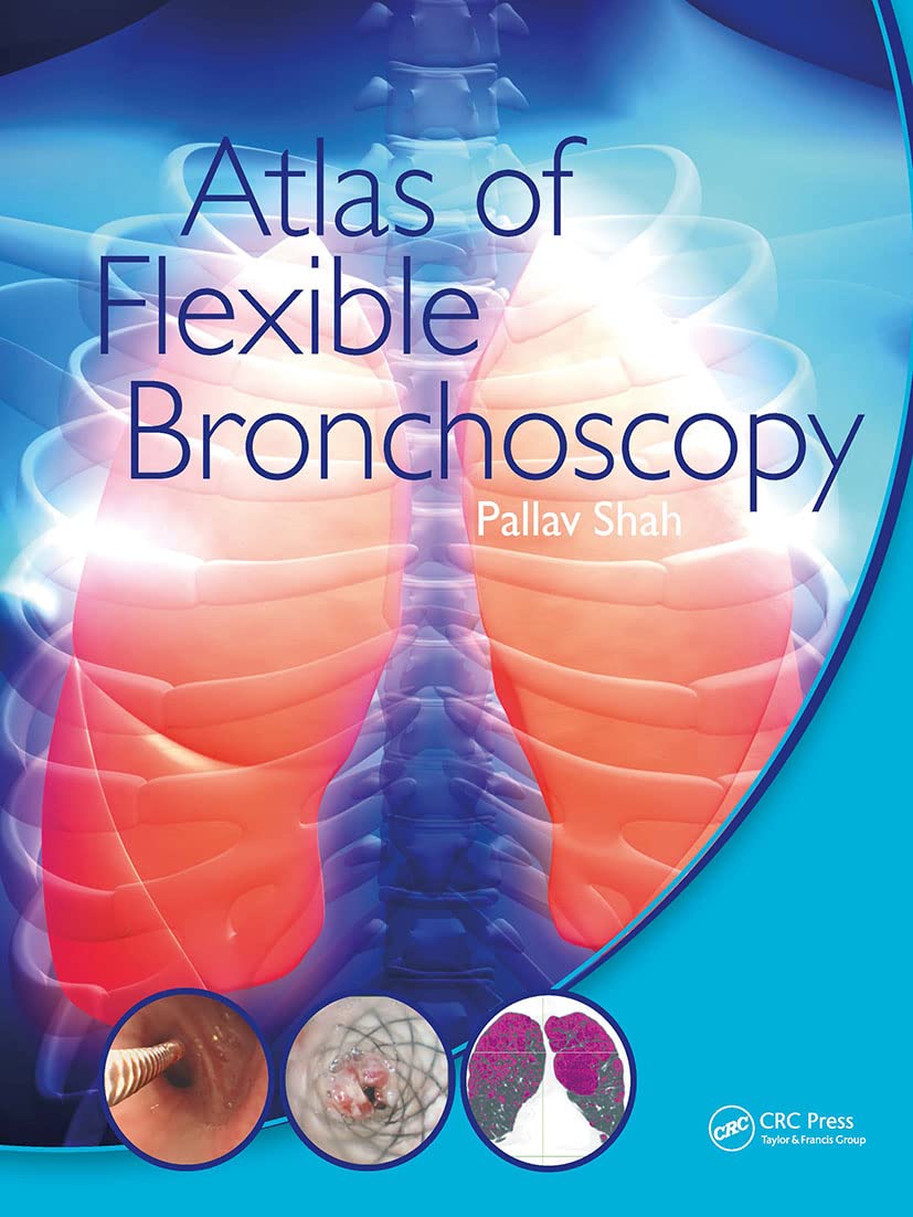 Atlas of Flexible Bronchoscopy Medicine