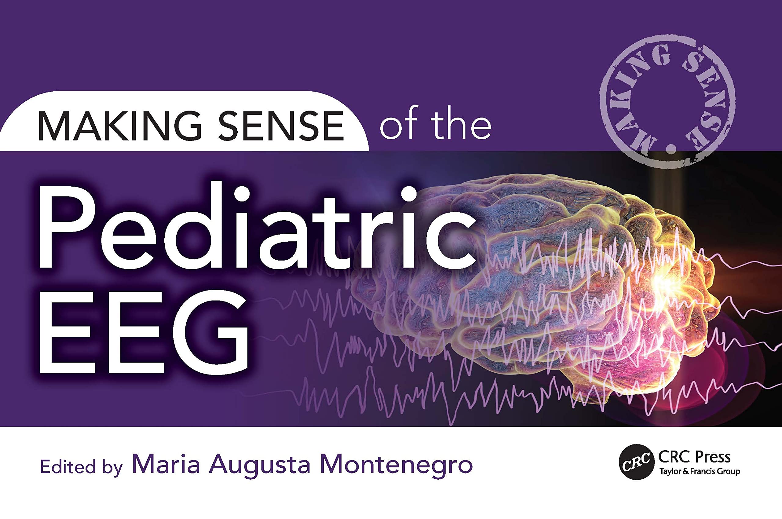Making Sense of the Pediatric EEG Medicine
